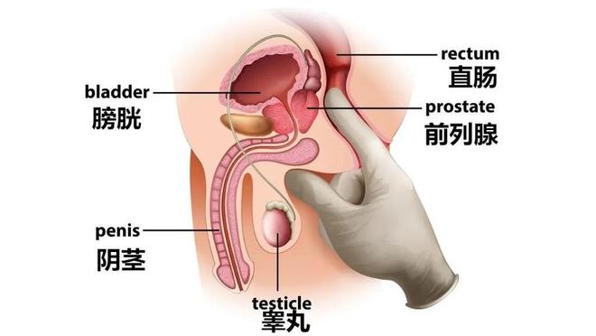 重度前列腺增生的最佳治療方法,重度前列腺增生的最佳治療方法與迅捷解答方案設(shè)計(jì),實(shí)地?cái)?shù)據(jù)驗(yàn)證策略_進(jìn)階款47.67.61