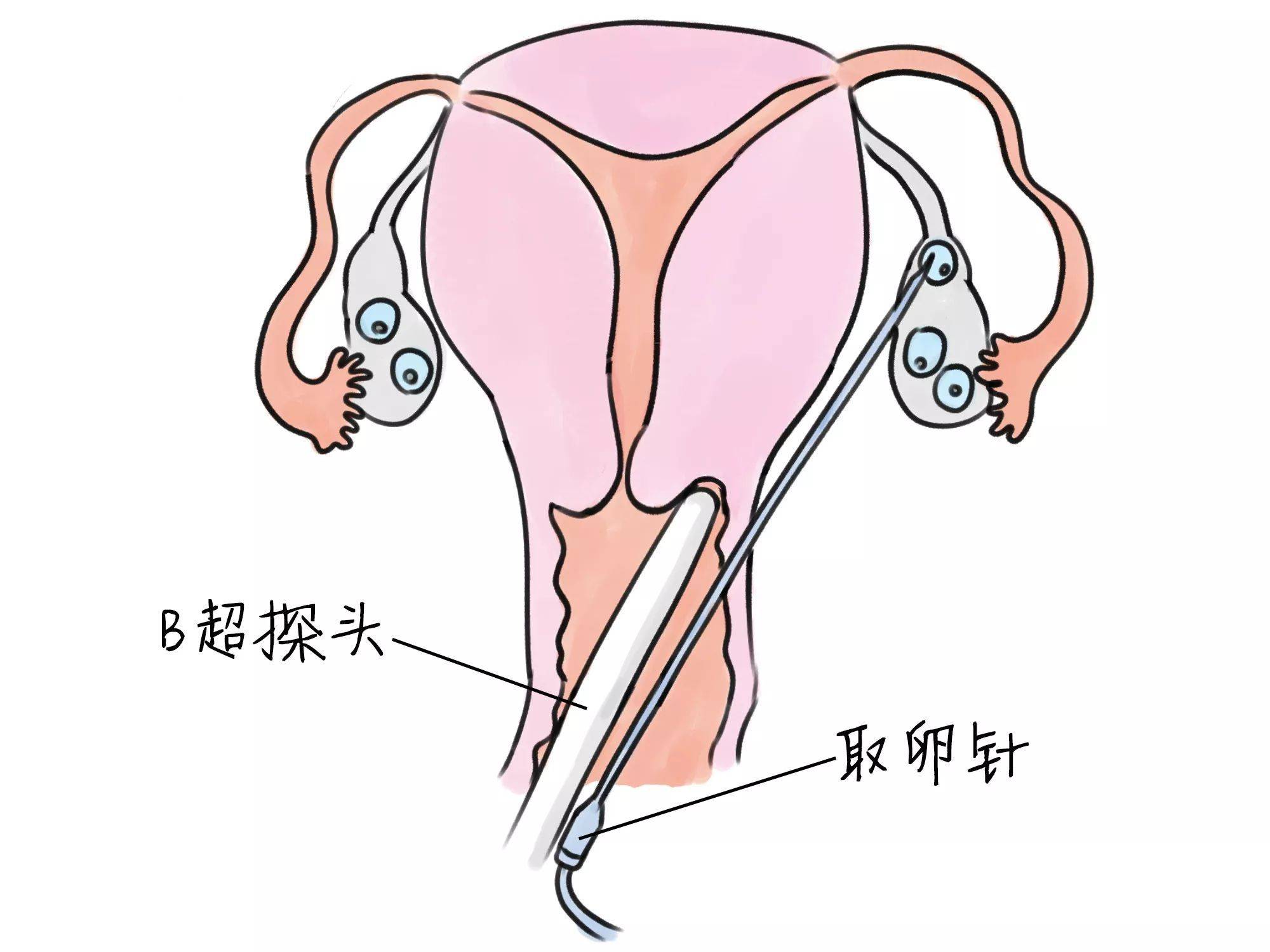 試管嬰兒怎么做的全過程需要多長時間,試管嬰兒制作全過程詳解，時間與實地執行考察方案,快速響應計劃解析_云版54.19.91