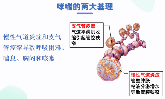 哮喘的主要癥狀是能治好么?,哮喘的主要癥狀及治療方法探討與創新計劃設計——以版納地區為例,安全性執行策略_RemixOS68.11.24